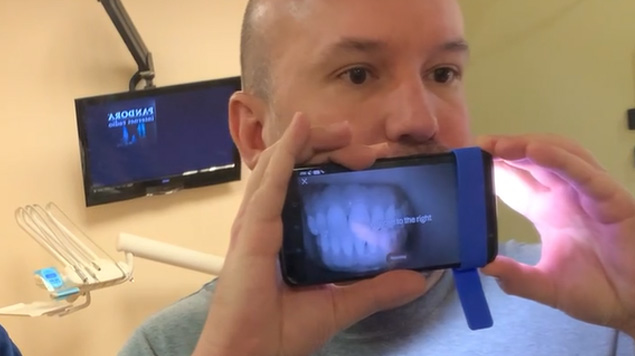Dental Scan Video