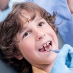 Tips for Getting Teeth Cleaning Dentist in Carrollton TX Area