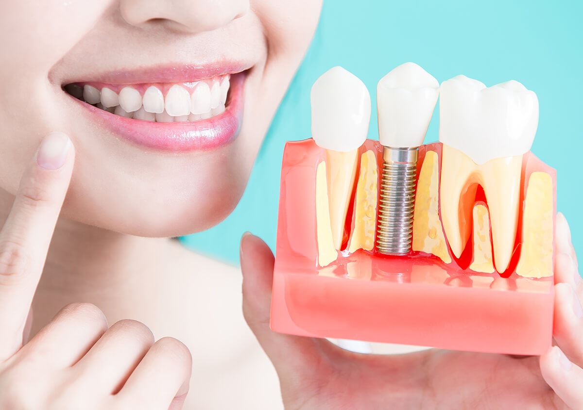Dental Implant in Dentist Carrollton TX Area