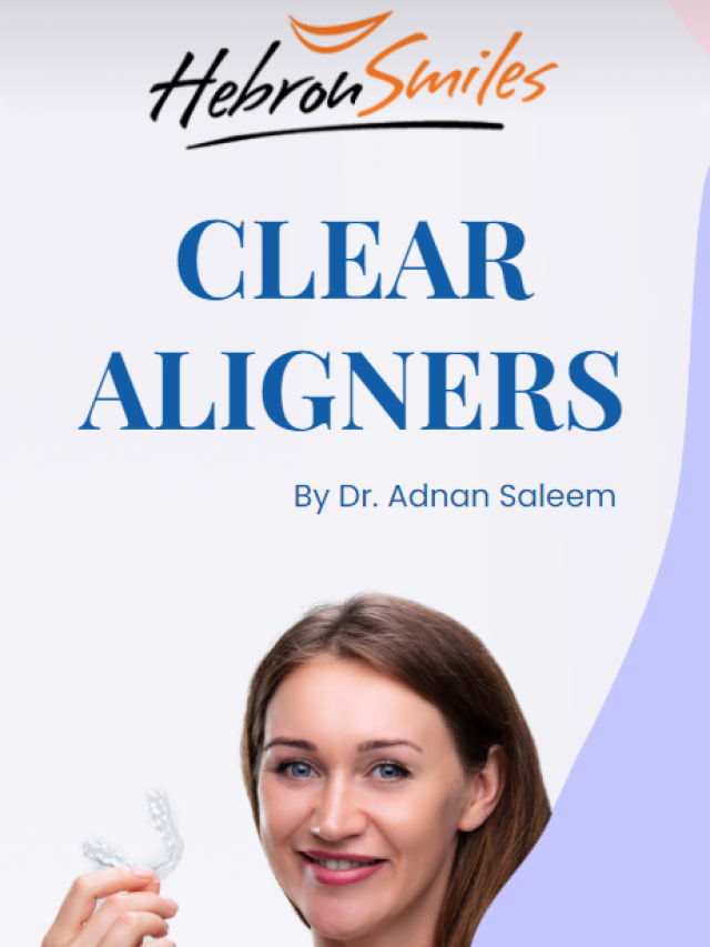 No More Brace Face – Clear Aligners