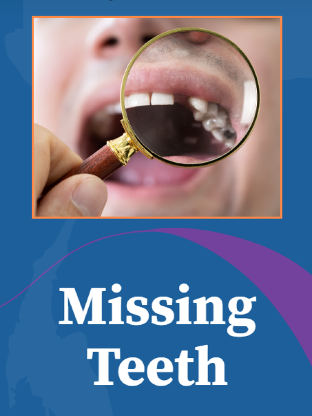 Missing teeth will affect the way you speak.